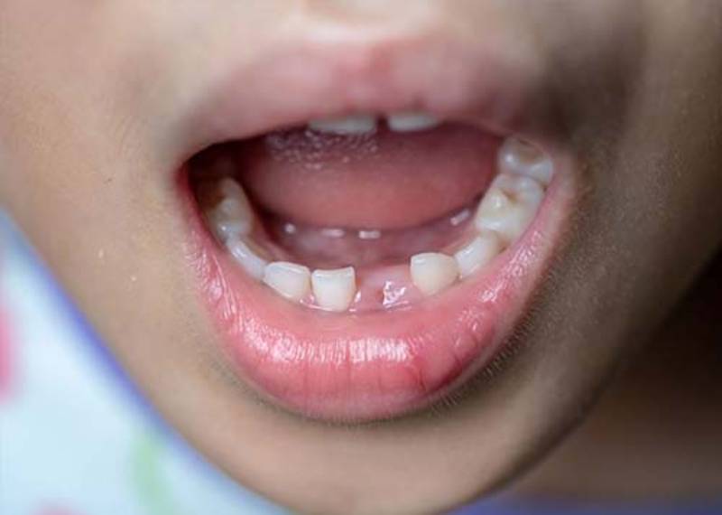 Nằm Mơ Thấy Rụng Răng Đánh Số Gì? Con Số “Vàng” Theo Dân Gian 4 Lời khuyên khi gặp giấc mơ rụng răng